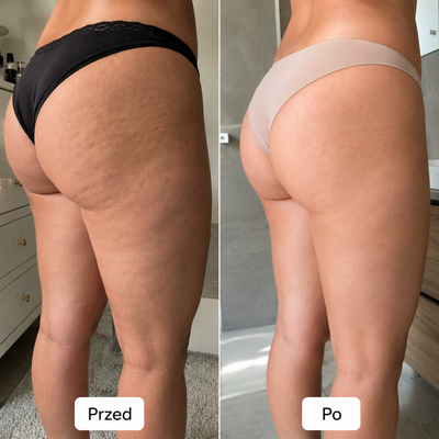 Zenvessa BodyContour Pro 3w1 – masażer próżniowy z EMS i czerwonym światłem